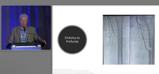 Surmodics Video Presentation