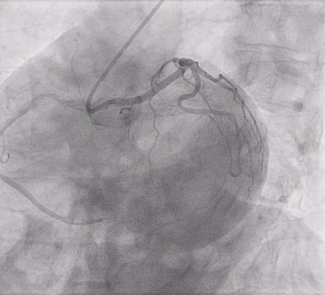 Bhattad Anomalous LM Video 4 Still image