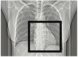 Keimer-Merschen Coronary Artery Disease Figure 2