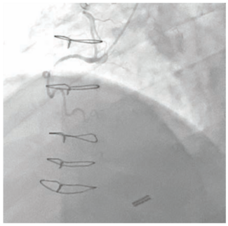 Raj Complex PCI Figure 1