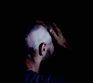 Alopecia Areata, blad head