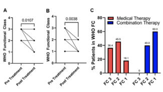 Kazmirczak Angioplasty Figure 2
