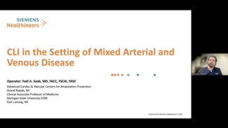 CLI in the Setting of Mixed Arterial and Venous Disease