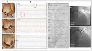 Karelas Smartwatch Figure 1