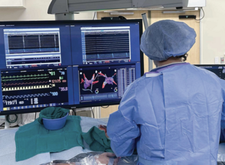 Prucka™ 3 with CardioLab™ Digital Recording System: The Gold Standard in Electrophysiology Labs