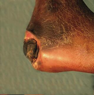 Photo courtesy of Kathleen Satterfield, DPM