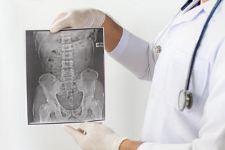 spinal xray