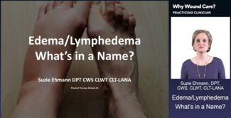 Suzie Ehmann, DPT, CWS, CLWT, CLT-LANA