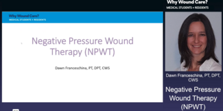 Dawn Franceschina, PT, DPT, CWS