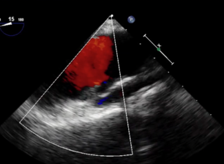 Bhattad CLD Oct 2023 Video 6