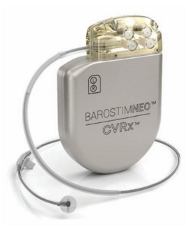 Economides Barostim System Figure 1
