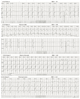 Golian Tunnel Vision Figure 1