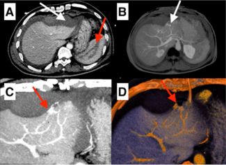 Figure. Computed tomography (CT) axial scan 