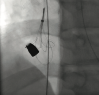 Terrill Figure 2A CLD Dec 2023