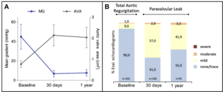 Figure 1. Echocardiographic outcomes. 