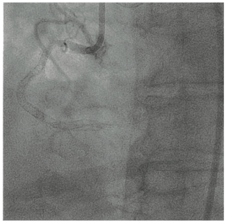 Oleszak Guidewire Figure 1