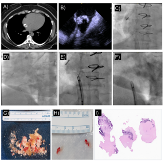 Figure. Computed tomography 