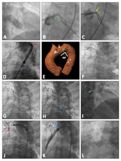 Cubero-Gallego Figure
