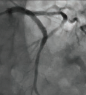 CLD Mahadevan Mar 2024 Figure 1H