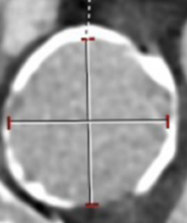 Casazza CLD Mar 2024