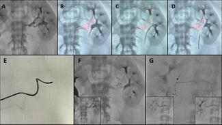 Figure. Highlights of the use of dynamic road-mapping 