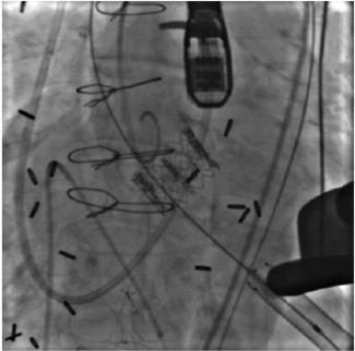 Kernis CLD March 2024