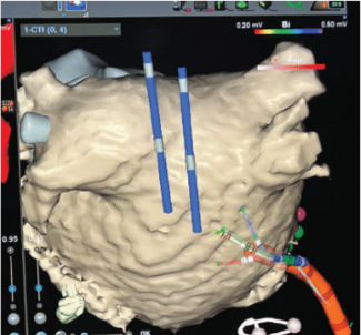 Barbhaiya-Fig3-May2024