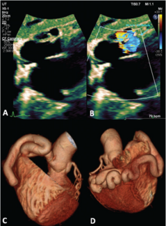 Holtzapple Fig 1 May 2024