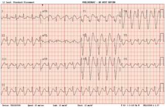 Prousi - June 2024 - Fig 1