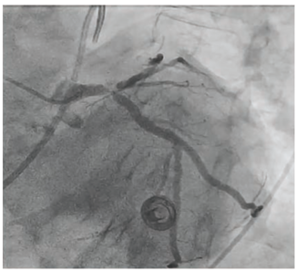 Waksman - Fig 1 - June 2024