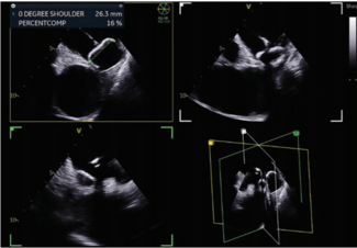 Gupta - Fig 7 - July 2024