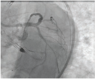 Bergmark Fig 3 July 2024