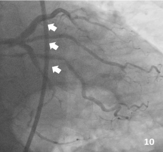 JIC June 2024 Hernandez et al, Figure 10