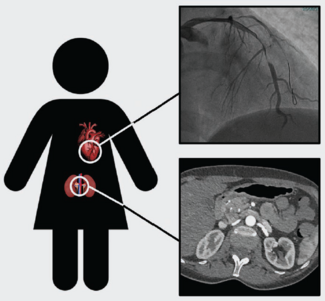 Sala-Cereda - Sum Fig - Aug 2024