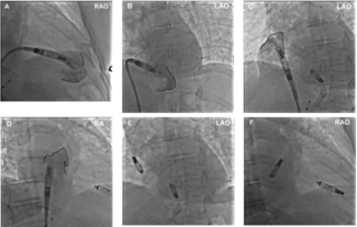 Diamantakos - Fig1 - EPLD - Sept 2024