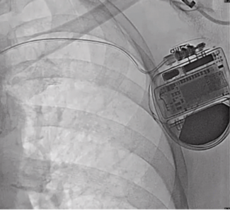 Mareddy - Fig 1 - Nov 2024 