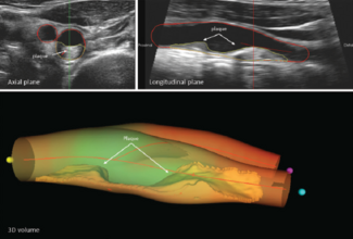 News - Figure - CLD - Nov 2024 