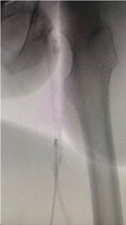 Silpe-Figure-CLD-Nov 2024 