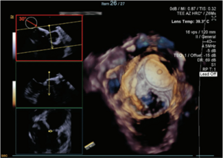 Thihalolipavan Fig 2 Dec 2024 
