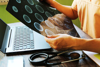 A doctor looks at a brain scan