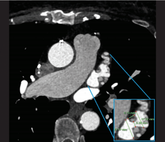 Gambhir-Fig1-Jan2025