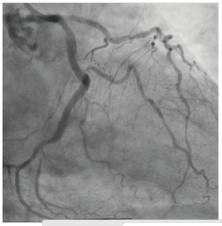CLD Vilchez Figure 7