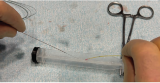 CLD-Feb 2025-Kern-Fig1