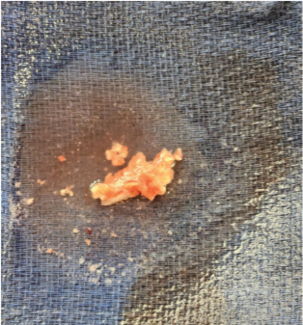 Turitto-Fig2-March2025