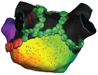 Atwater-Fig1-April 2025.png 