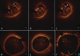 Cilingiroglu Figure 2