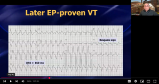 <iframe width="560" height="315" src="https://www.youtube.com/embed/Zpub4pZ1ON0?si=tBZD3RXZttSwByvr" title="YouTube video player" frameborder="0" allow="accelerometer; autoplay; clipboard-write; encrypted-media; gyroscope; picture-in-picture; web-share" referrerpolicy="strict-origin-when-cross-origin" allowfullscreen></iframe>