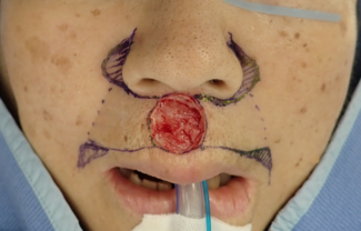 Figure 3A of article