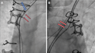 Willett-Fig4-EPLD-Sept 2025.png