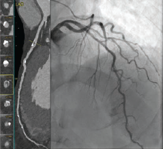 imaging corner fig1 oct 2025.png 